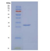 小鼠含V-Set免疫球蛋白域蛋白8(VSIG8)重组蛋白C-