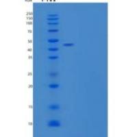 人微管相关蛋白τF/MAPT-F/τ-F重组蛋白