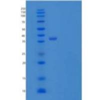 人载脂蛋白H(APOH)重组蛋白C-6His