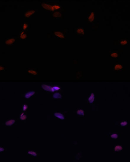 Anti-PARP1 Polyclonal Antibody