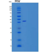 人雌激素受体β/ERβ/NR3A2重组蛋白N-6His