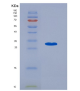 人果糖二磷酸醛缩酶A(ALDOA)重组蛋白