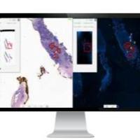 PathFusion 数字病理图像分析软件
