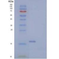 人酶原粒蛋白16同源物B(ZG16B)重组蛋白C-6His