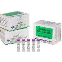 人类免疫缺陷病毒1型抗体（抗HIV-1）血清（液体）标准物质