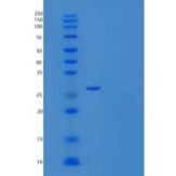 人蛋白磷酸酶1G/PP1MG重组蛋白C-6His