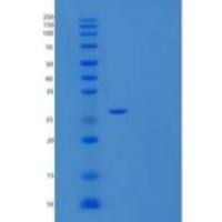 人蛋白磷酸酶1G/PP1MG重组蛋白C-6His
