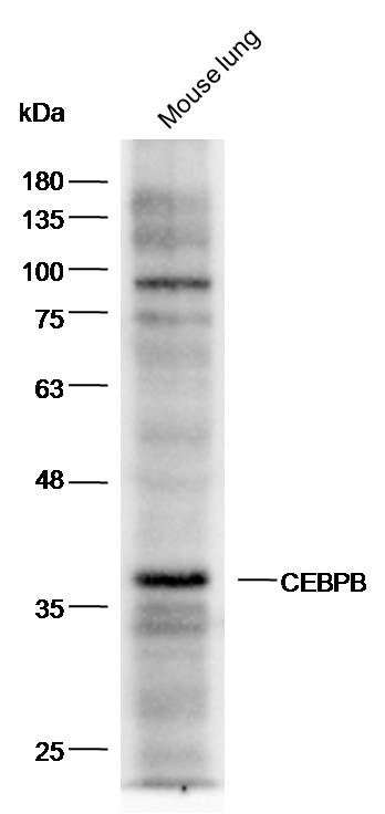 Anti-CEBPB Polyclonal Antibody