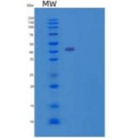 人胎球蛋白B(FETUB)重组蛋白C-6His