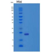 人白细胞单免疫球蛋白样受体1/LMIR1/CD300a重组蛋白C-6His