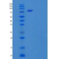 人蛋白二硫化物异构酶A4(PDIA4)重组蛋白C-6His