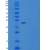 人Carbonic Anhydrase 10/CA10重组蛋白N-6His