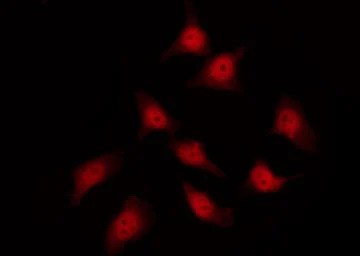 HSP27 (phospho Ser82) antibody