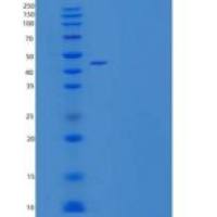 人B3GNT1 重组蛋白C-6His