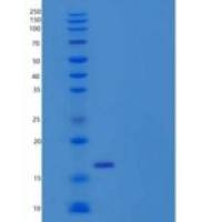 小鼠肿瘤坏死因子/肿瘤坏死因子α重组蛋白