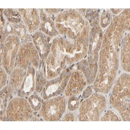 HSP27 (phospho Ser82) antibody