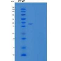 人左右决定因素2重组蛋白N-6His