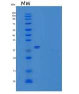 人Sentrin特异性蛋白酶7/SENP7重组蛋白N-6Hi