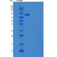 人β-内酰胺酶样蛋白2/LACTB2重组蛋白N-GST