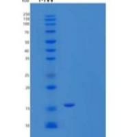 人脂肪酸结合蛋白1/FABP1/L-FABP重组蛋白N-6His