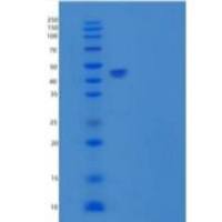 人羧肽酶B2(CPB2)重组蛋白C-6His