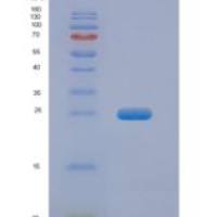 人成纤维细胞生长因子19(FGF19)重组蛋白