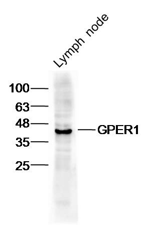Anti-GPER1 Polyclonal Antibody