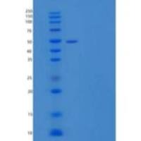 人蛋白质N-末端谷氨酰胺水解酶/NTAQ1重组蛋白