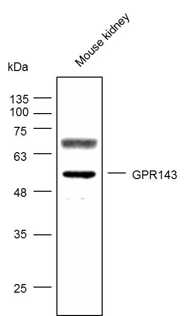 Anti-GPR143 Polyclonal Antibod