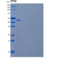 人卡尔涅辛/CANX重组蛋白C-6His