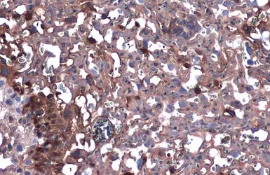 DAG1 / beta Dystroglycan antib