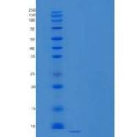 人前神经肽Y/NPY重组蛋白C-6His