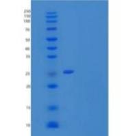 人天青菌素/CAP37/HBP重组蛋白C-6His