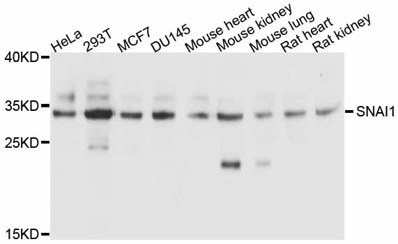 Anti-SNAI1 Polyclonal Antibody