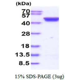 Human Casein Kinase 2 alpha pr