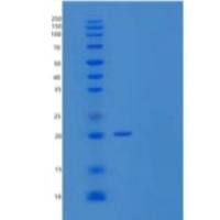 人晶状体蛋白αB(CRYaB)重组蛋白C-6His