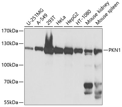 Anti-PKN1 Polyclonal Antibody