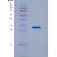 人果糖二磷酸醛缩酶A(ALDOA)重组蛋白