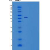 人白细胞弹性蛋白酶抑制剂/丝氨酸蛋白酶抑制剂B1重组蛋白C-6His