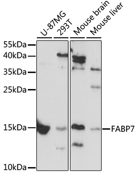 Anti-FABP7 Polyclonal Antibody