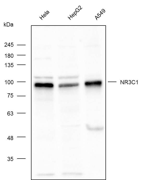 Anti-NR3C1 Polyclonal Antibody