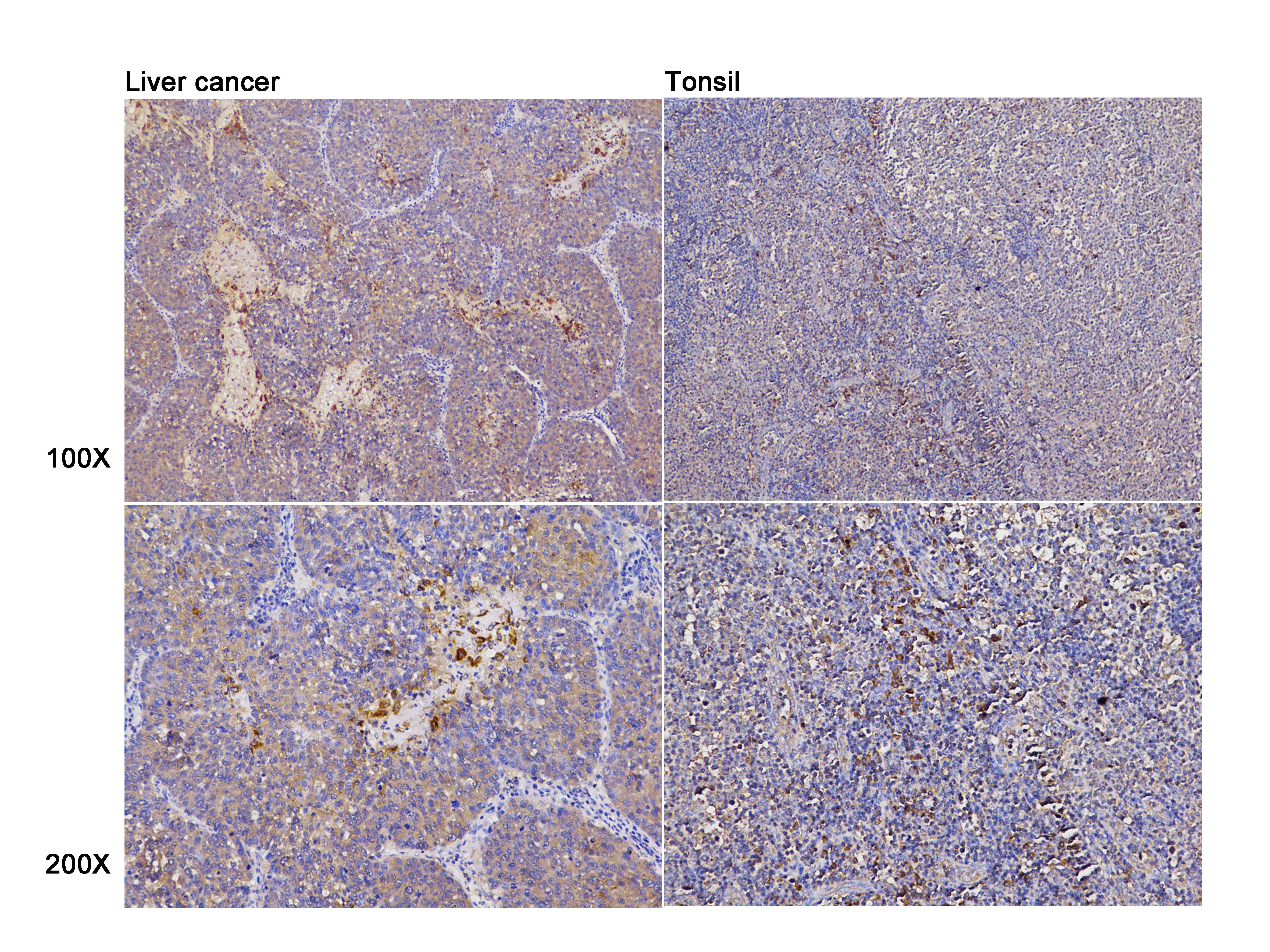 Anti-TSC1 Polyclonal Antibody
