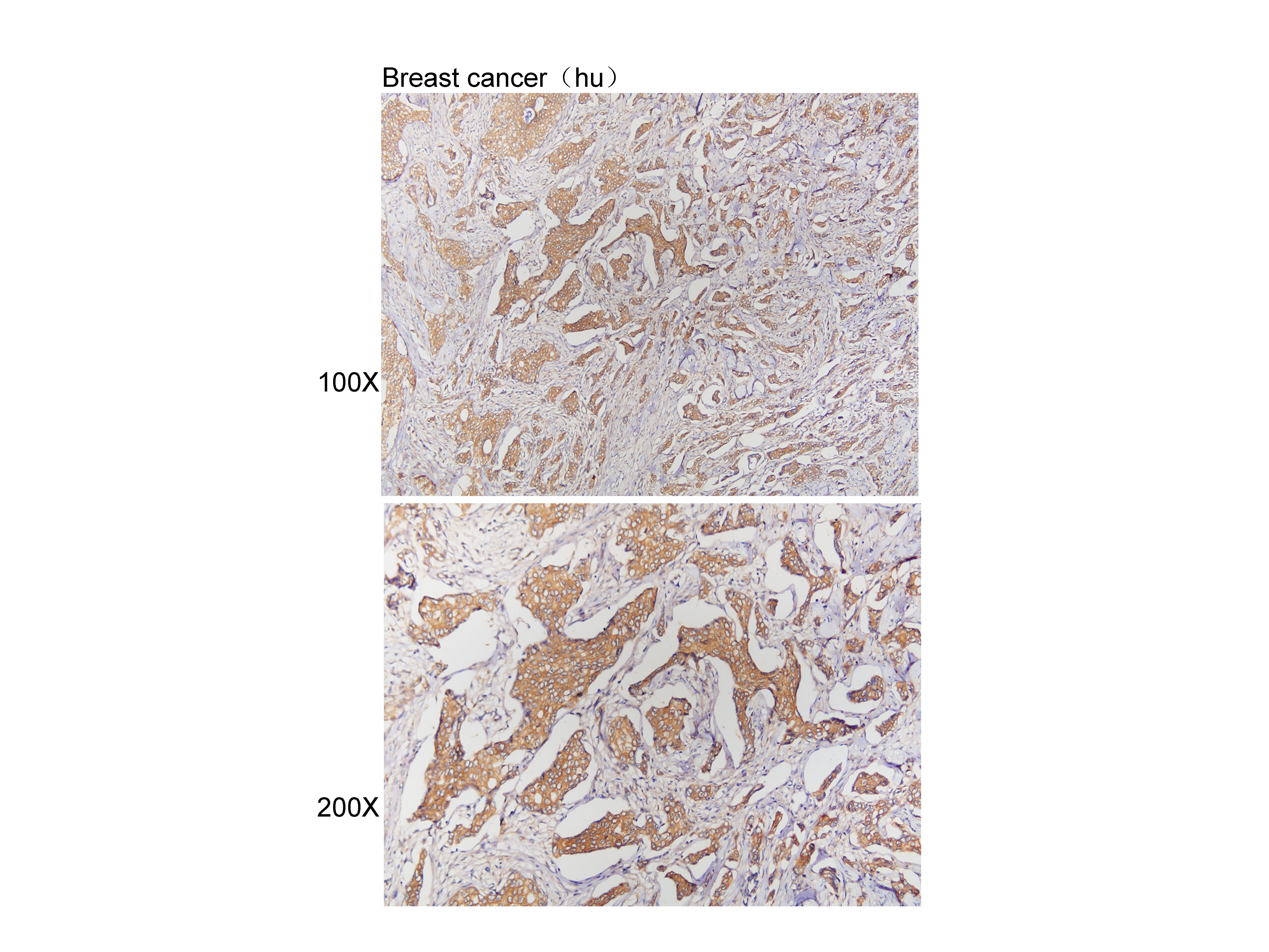 Anti-HDAC6 Polyclonal Antibody