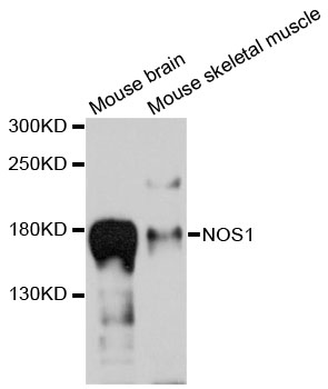 Anti-NOS1 Polyclonal Antibody