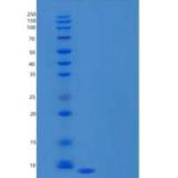 人趋化因子C-C-基元配体3样蛋白1(CCL3L1)重组蛋白C-6His