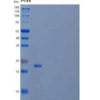 人LYVE-1/HAR/XLKD1重组蛋白C-6His