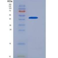 人CD32a / FCGR2A重组蛋白167 Arg, Fc tag