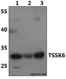TSSK6 antibody