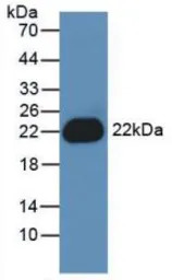 Human IL1 beta protein, His ta