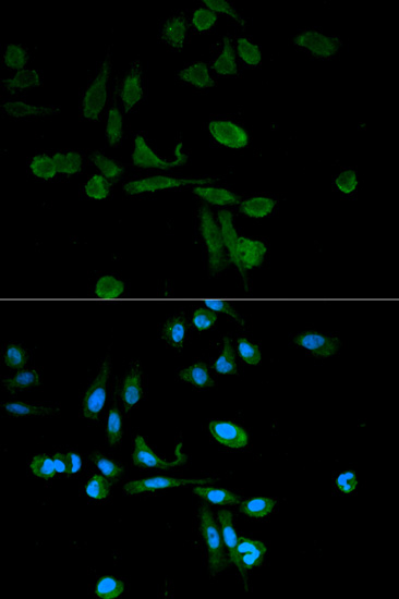 Anti-SIRT7 Polyclonal Antibody